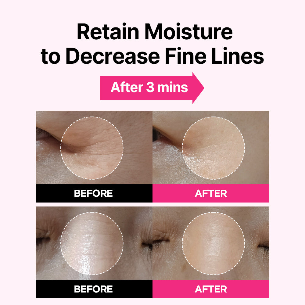 Blemish Care Eye & Wrinkle Patch