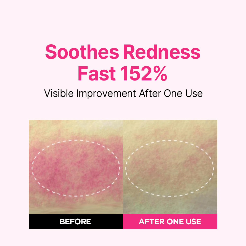 [Bestseller] Blemish Serum Triple Set